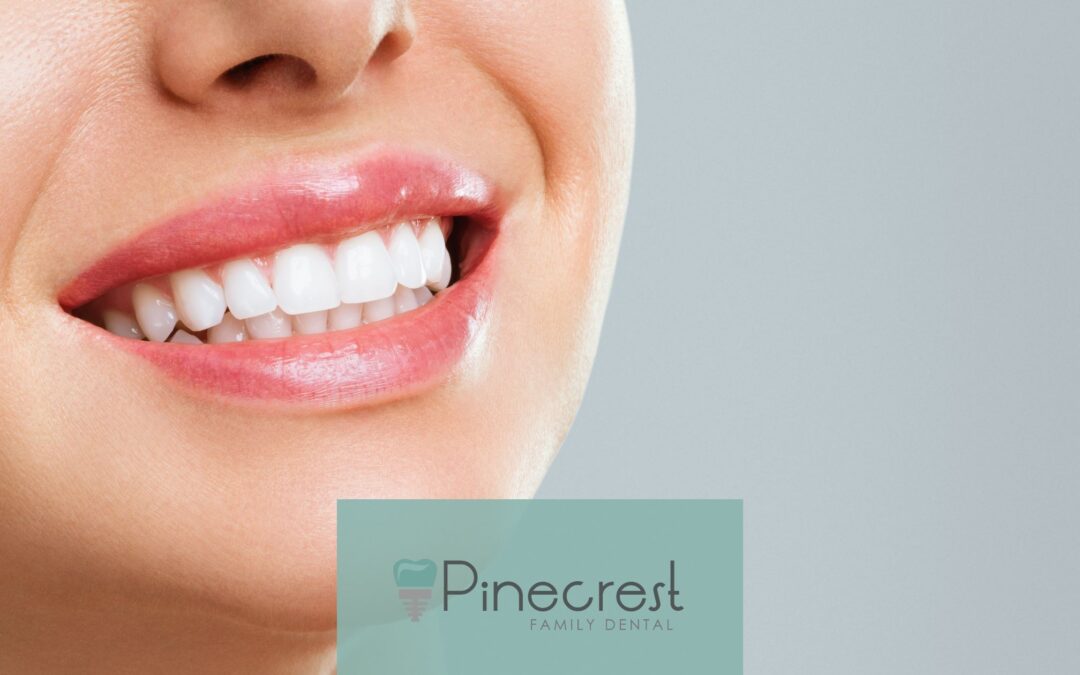 teeth whitening